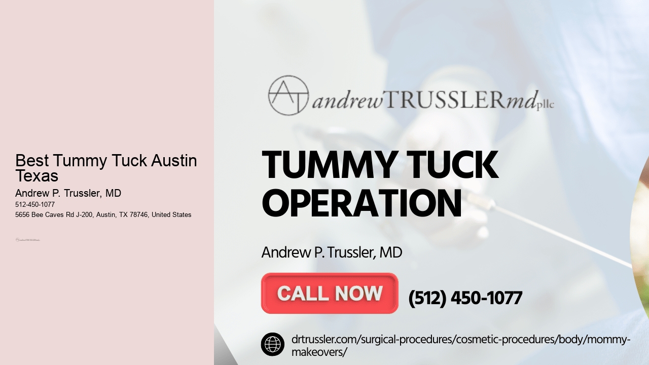 Best Tummy Tuck Austin Texas